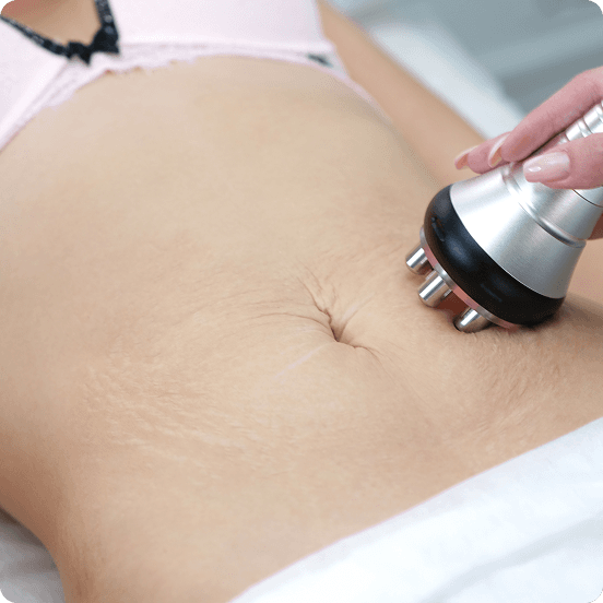 Lymphatic Elevation RF Detox